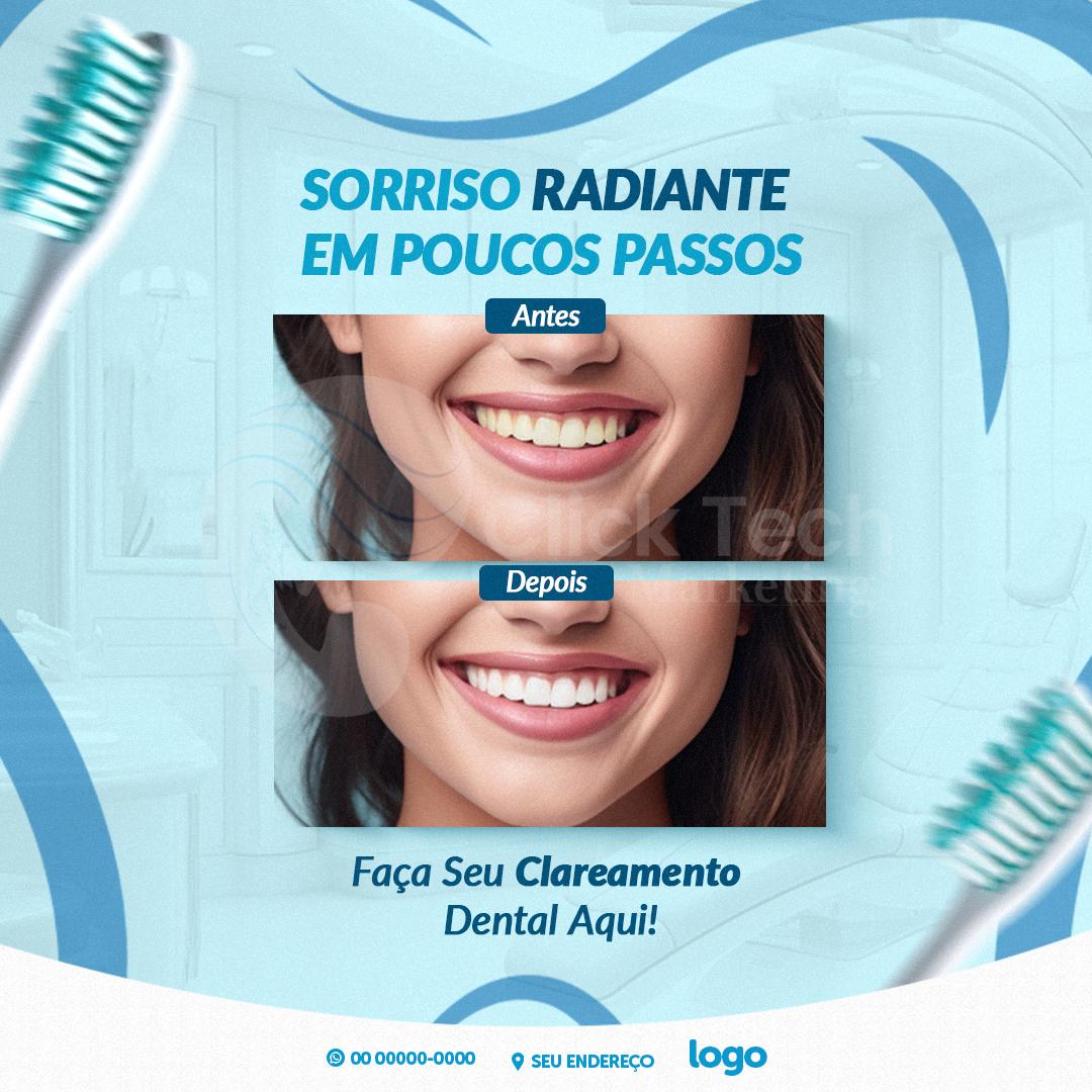 Sorriso radiante em poucos passos