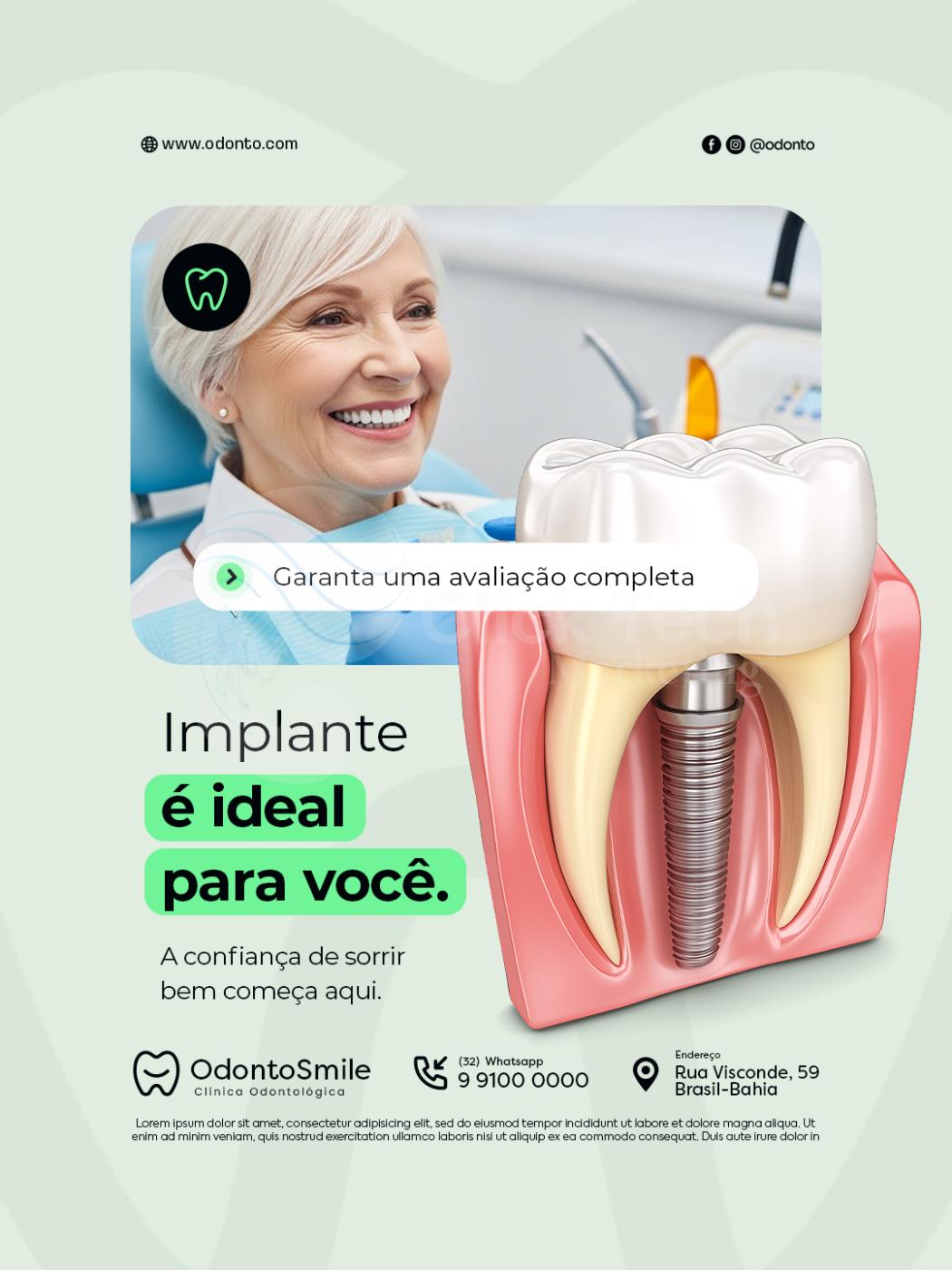 Implante é ideal para você